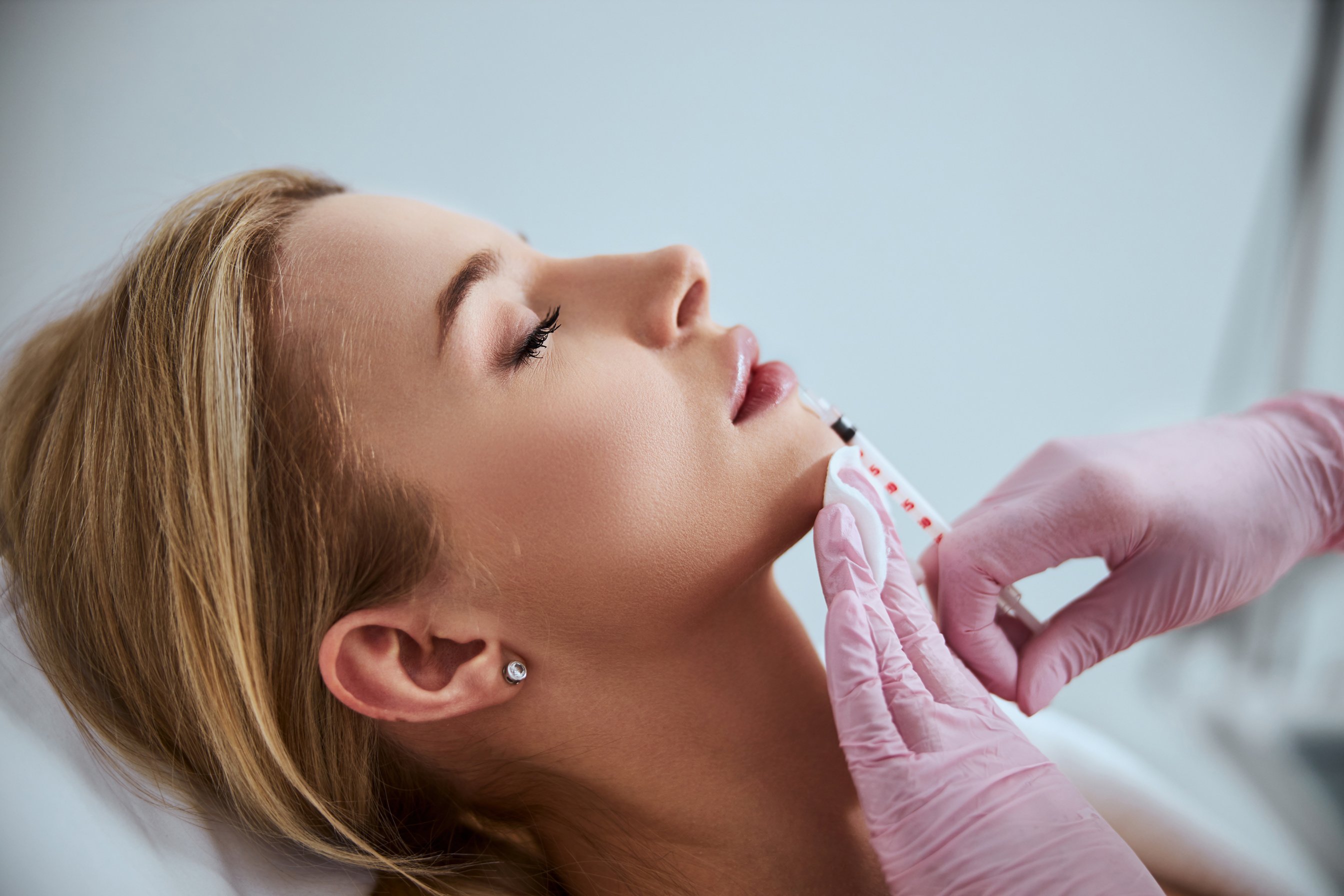 Aesthetic practitioner administering Vitallur® dermal filler treatment to a patient.